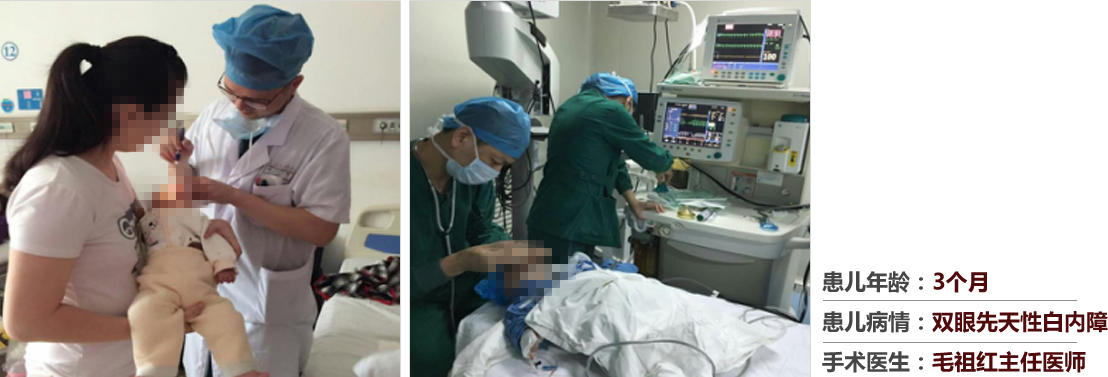 患兒年齡：3個(gè)月，患兒病情：雙眼先天性白內(nèi)障，手術(shù)醫(yī)生：毛祖紅主任醫(yī)師