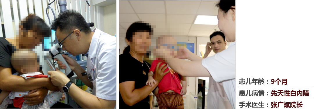 患兒年齡：9個(gè)月，患兒病情：先天性白內(nèi)障，手術(shù)醫(yī)生：張廣斌院長(zhǎng)