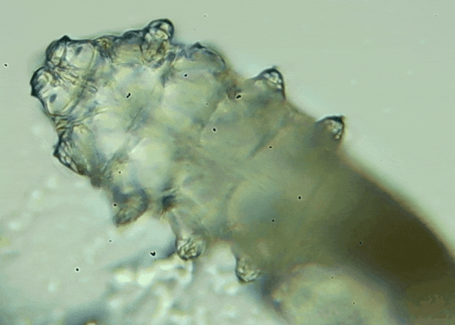 睫毛上驚現(xiàn)80只螨蟲！別揉了，快自查下你的眼睛有沒(méi)有......